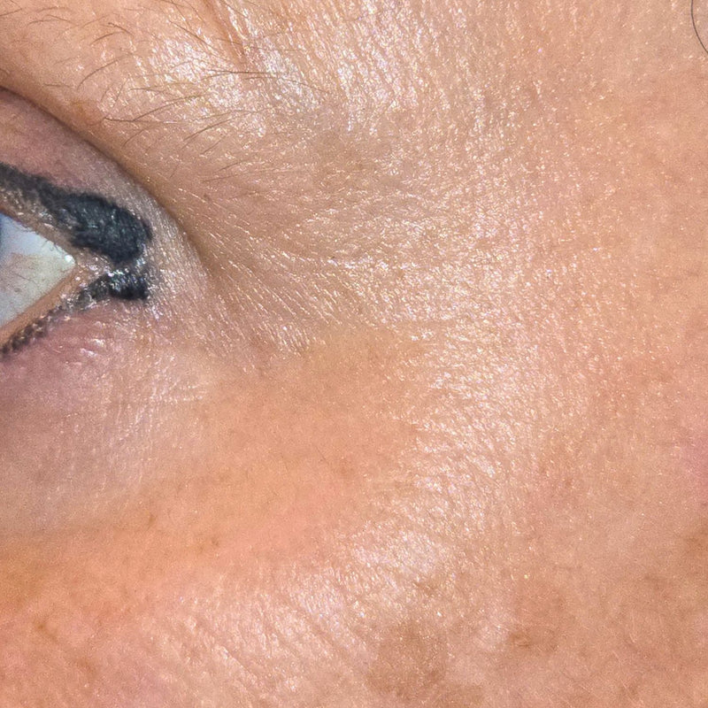 EYE – Nachher